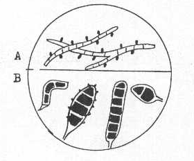 http://www.mikrobiyoloji.org/tr/genel/resimgoster.aspx?dil=1&belgeanah=3433&resimisim=g110013500_5.gif