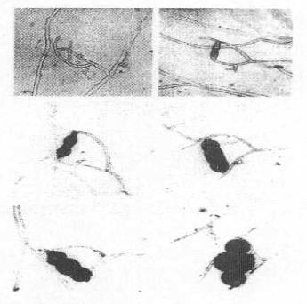 http://www.mikrobiyoloji.org/tr/genel/resimgoster.aspx?dil=1&belgeanah=3435&resimisim=j110013500_10.jpg