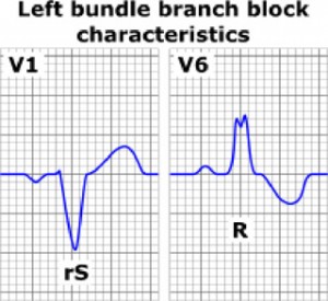 http://www.af-ablation.org/pappone/wp-content/uploads/2009/11/tracciati1-300x275.jpg