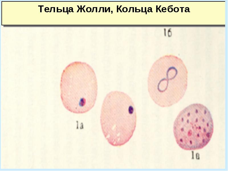 Анемии классификация патогенез лечение