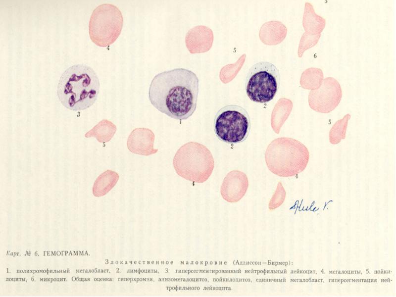 Анемии классификация патогенез лечение