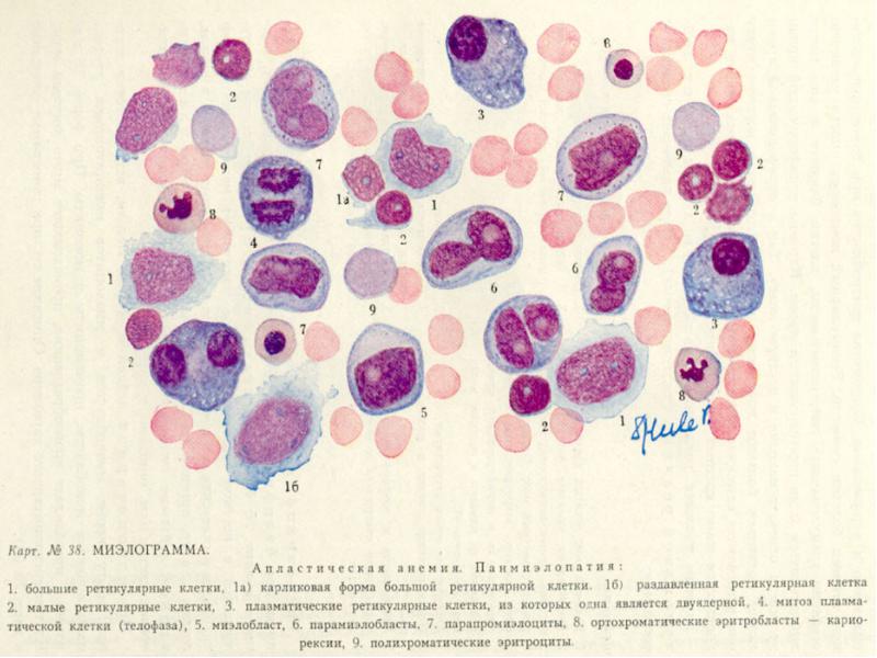 Анемии классификация патогенез лечение