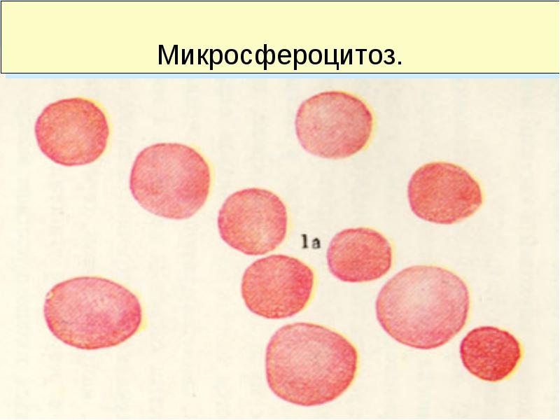 Анемии классификация патогенез лечение