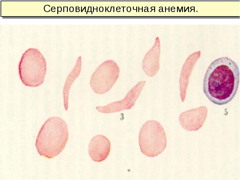 Анемии классификация патогенез лечение