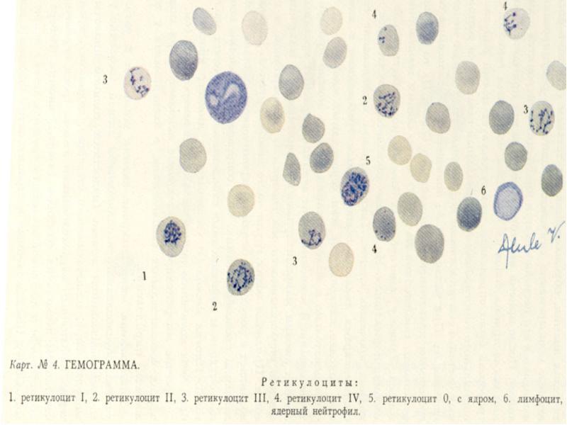 Анемии классификация патогенез лечение