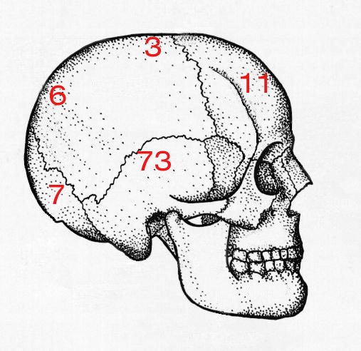 d:\viktoro\neuroscience\trh. head trauma\00. pictures\epidhem percentages.jpg