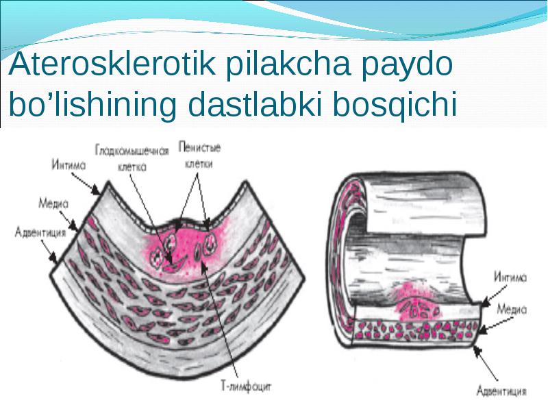 Фиброз члена