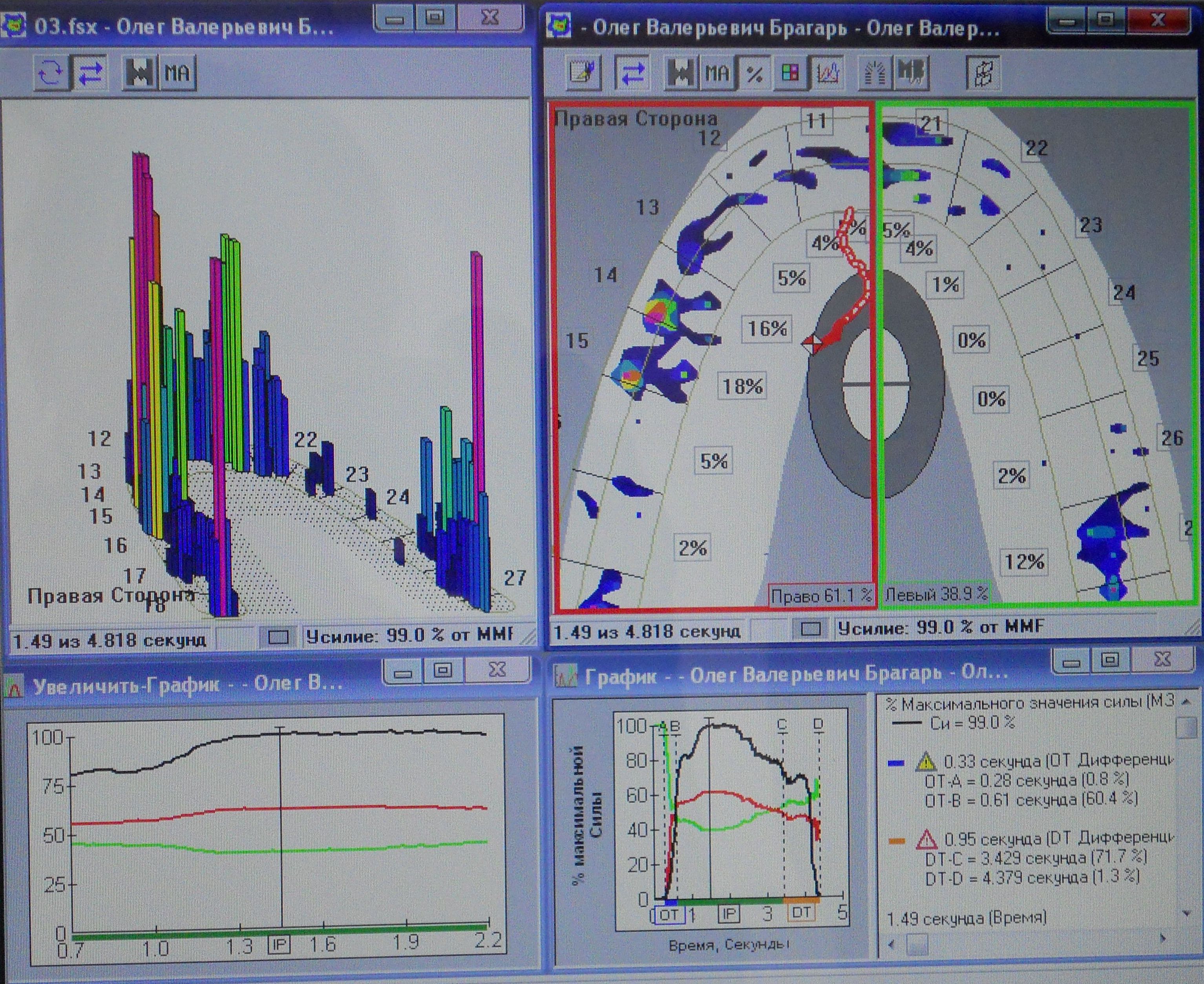 Программа для анализа вайлдберриз. Анализ программ. G-scan 3 - Интерфейс программы. Интерфейс для программы для анализа статистики. Компьютерный анализ окклюзии t-scan.