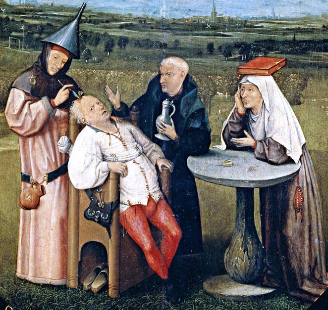 history of trepanation.jpg